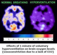 Normal Breathing Versus Hyperventilation