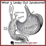 Leaky Gut Syndrome