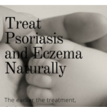 Treat Psoriasis and Eczema Naturally